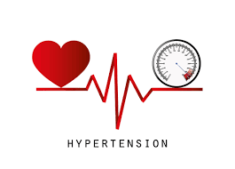 Understanding Hypertension